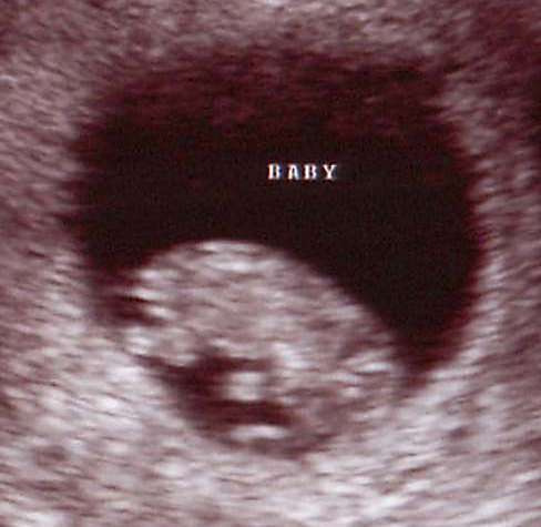 Baby01.jpg