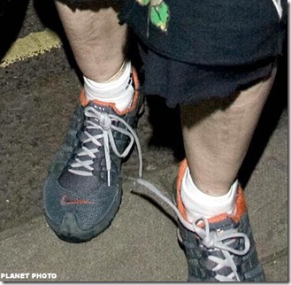 Madonna's stubbly looking legs picture