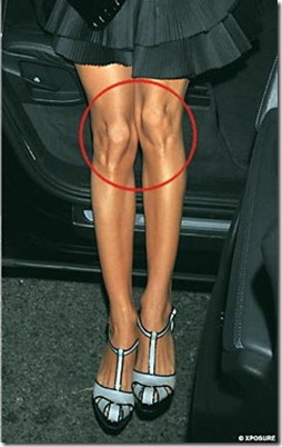 Eva Longoria's knobbly knees picture