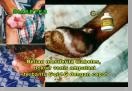diabetes-sembuh-2