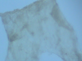 skin tinea x60.jpg