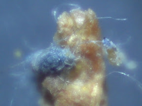 dog vomit with fibers.jpg
