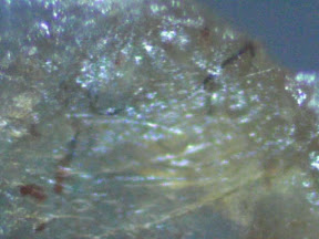 back lesion scab top 2 200x.jpg