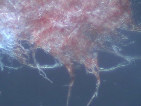 blood kleenex 60x.jpg