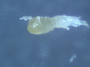 nasal sebum plug 60x.jpg