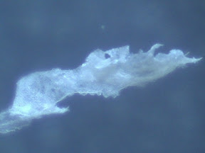 tinea foot skin 2 60x.jpg