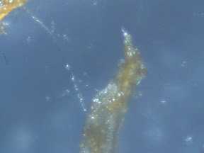 chicken skin 4 60x.jpg