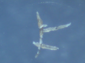 hot shower rubbed skin, rolled fibers 2 60x.jpg