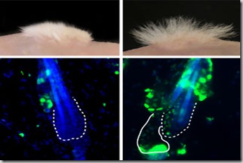 stemcellhair