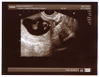 ultrasound3