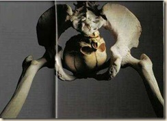 remains_politician