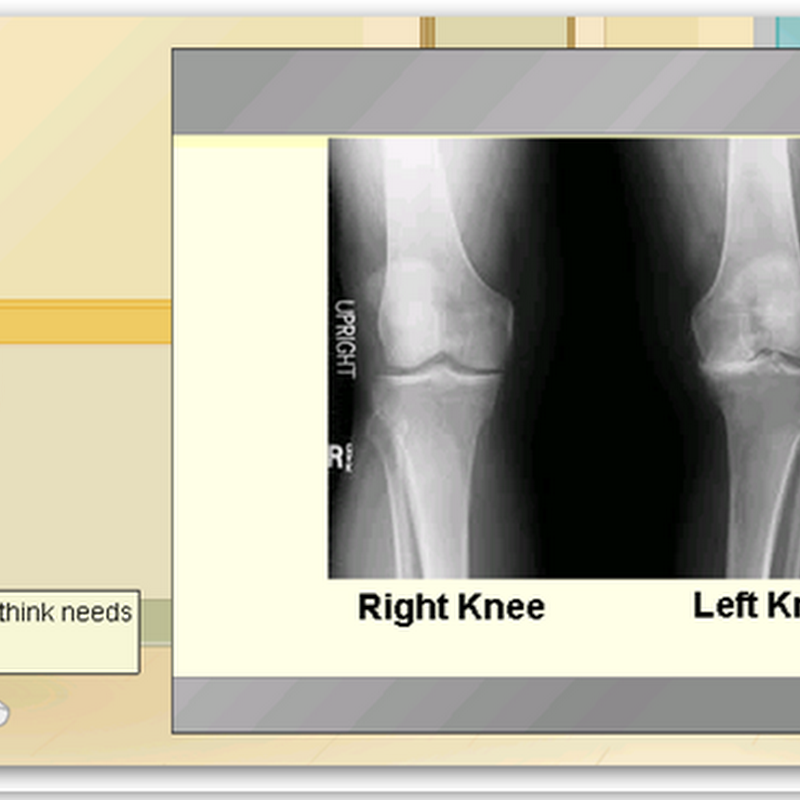 Welcome to Edheads Virtual Knee Surgery