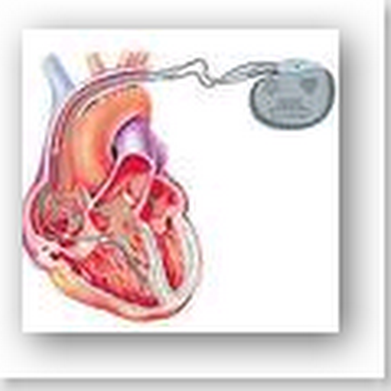 Critical Shock Treatment Often Delayed in Cardiac Arrest
